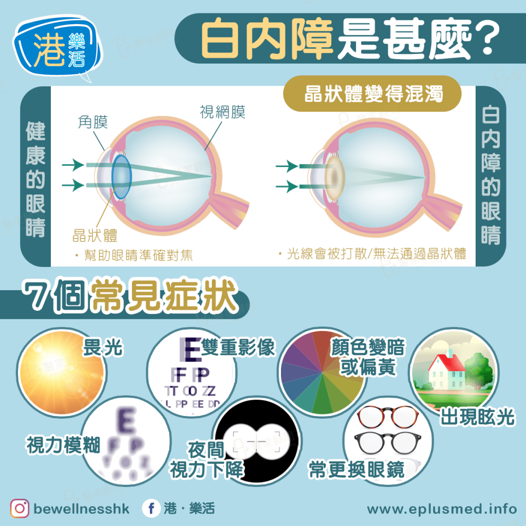 bewellnesshk fb cover_what is cataract
