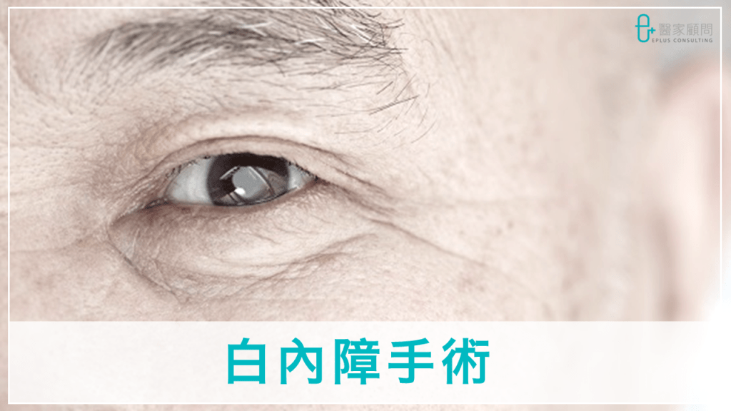 Medinfo cover_ophthalmology 眼科_Cataract OT