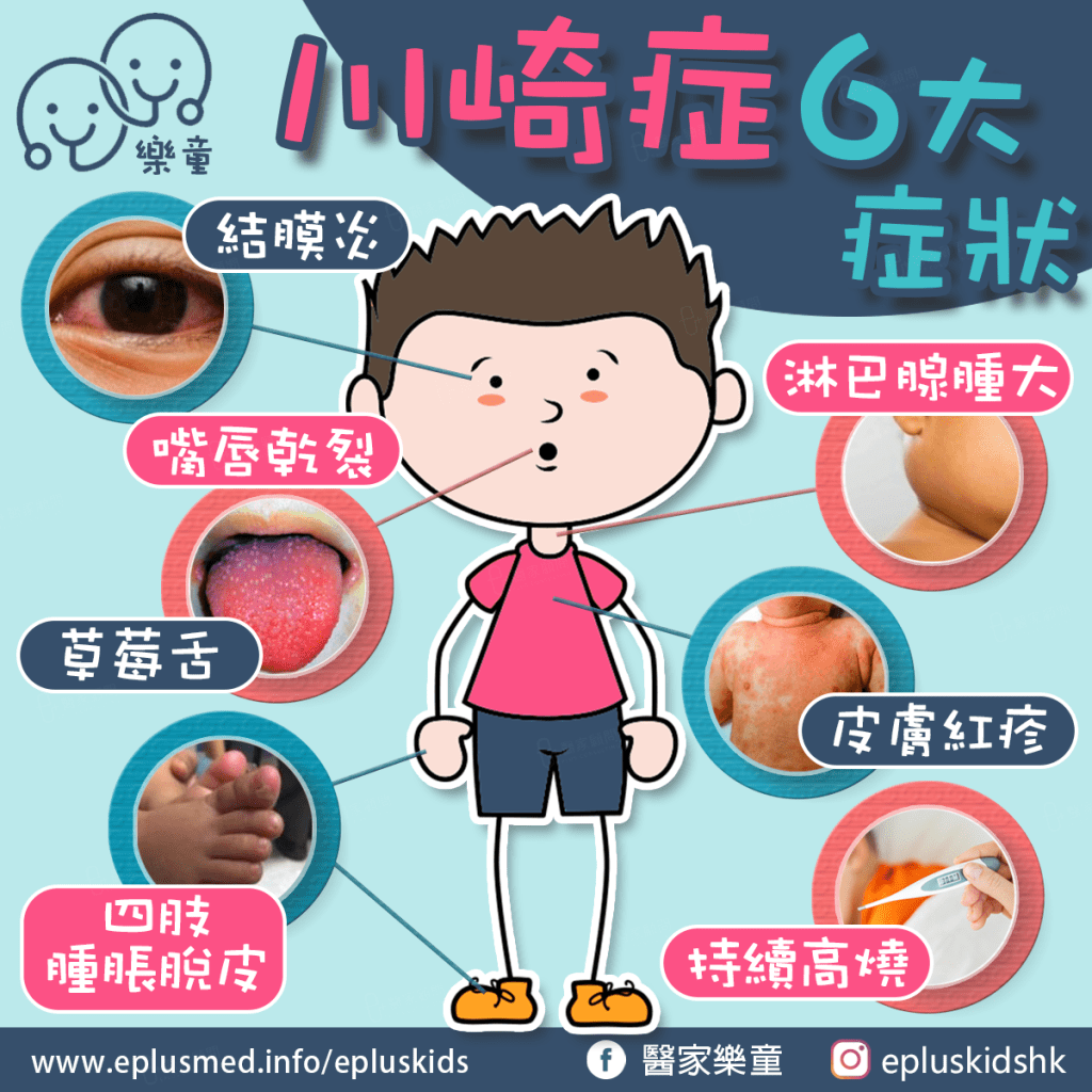 Epluskids fb cover_Kawasaki disease 2024