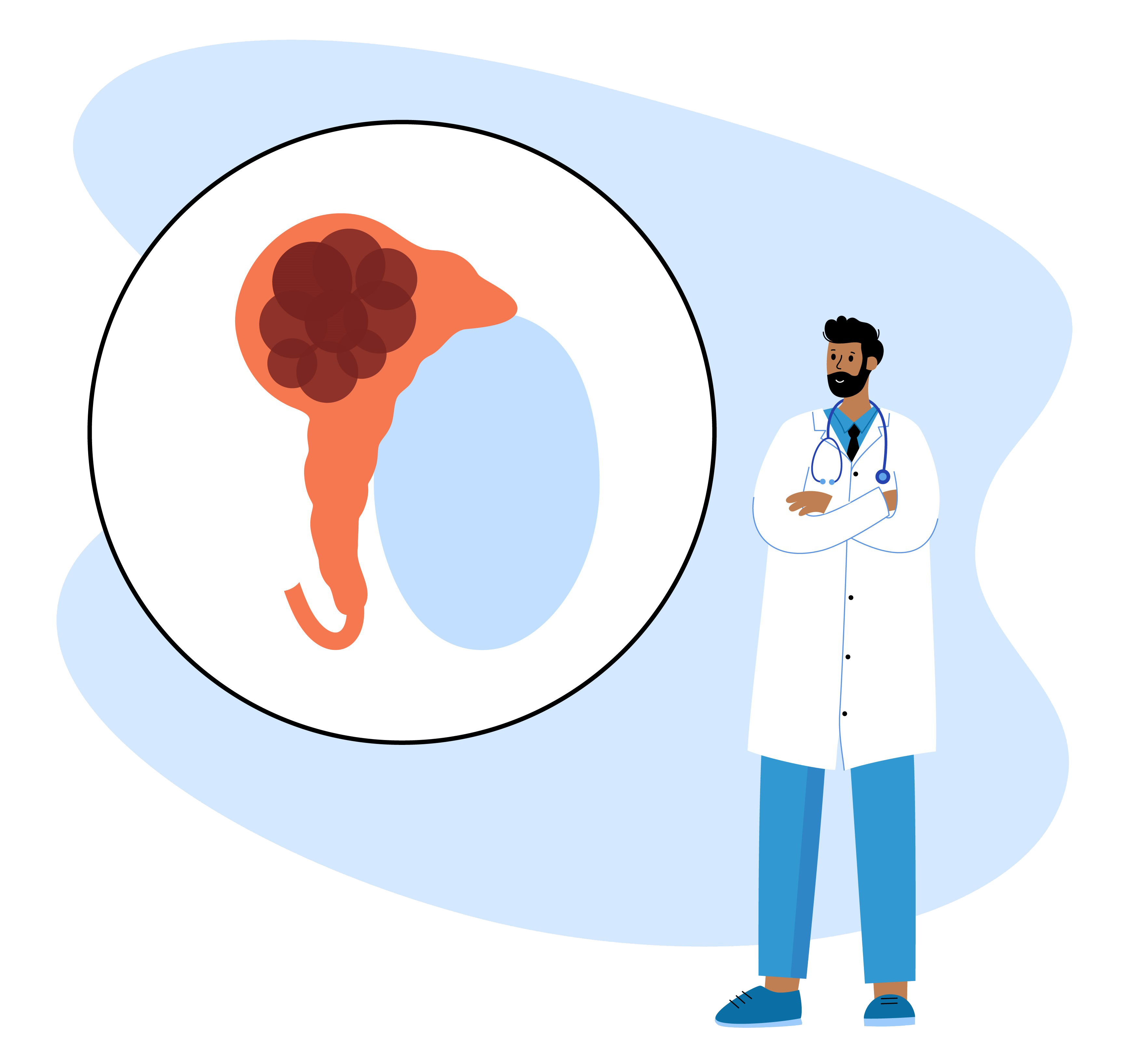 睪丸癌 (Testicular Cancer) – 醫家顧問