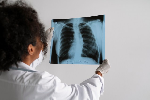 X光造影 (X Ray Examination) – 醫家顧問